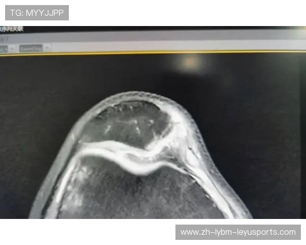 赛季报销勇士官方确认穆迪左膝髌腱撕裂本周接受手术治疗